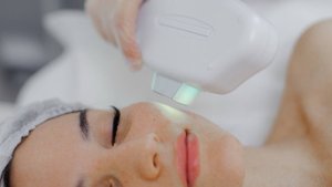 Elos омоложение