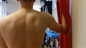 Стабилизация лопатки