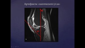 Базовый курс по МРТ- 1. Лекция «Общая семиотика в МР-артрологии». Лектор- Учеваткин А.А._2