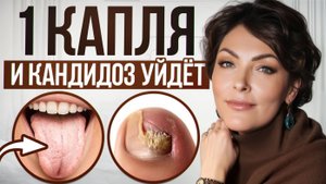 Как уничтожить кандидоз НАВСЕГДА / Простой рецепт в домашних условиях