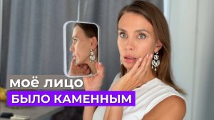 Почему не стоит слепо верить косметологам: мои ошибки и выводы