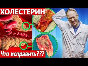 Как ПОНИЗИТЬ ХОЛЕСТЕРИН, и когда это надо делать