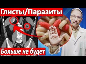 НАВСЕГДА избавиться от ГЛИСТОВ паразитов и гельминтов ПРОСТО