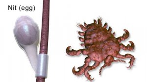 Вши: строение, виды, цикл жизни и борьба с паразитами + Блоха и природные очаги