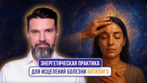 Энергетическая практика для исцеления болезни витилиго | Сергей Жигалко