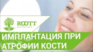 Имплантация при недостатке костной ткани. Имплантация при недостатке костной ткани без пластики.