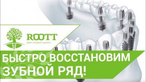 Имплантация зубов новые технологии. Система ROOTT применяет новейшие технологии в имплантации.