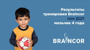 Результат тренировки с нейростимулятором BrainCor при ДЦП