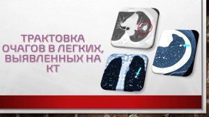Трактовка очагов в легких, выявленные на КТ