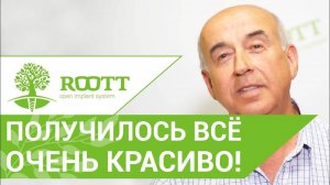 "Все красиво, я доволен. Полная имплантация всех зубов за 4 дня. Отзыв пациента