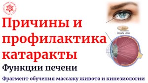 Причины и профилактика катаракты. Функции печени. Фрагмент обучения массажу живота и кинезиологии