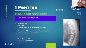 10 фактов, которые вы НЕ знали о сутулости и гиперкифозе