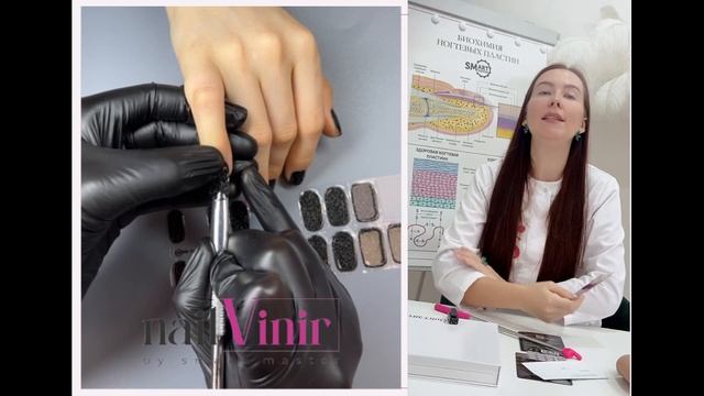 СЕМИНАР ПО ВИНИРАМ