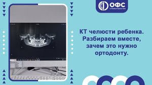 КТ челюсти ребенка. Разбираем вместе, зачем это нужно ортодонту.