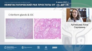 Лекция: «Динамика развития представлений о морфологии рака простаты»