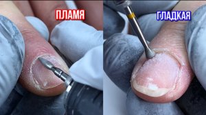 Пламя VS  Гладкая фреза. Что лучше?