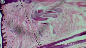 Кожа человека под микроскопом