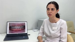 Стоматология Leib Medic - клинический случай из практики (ортодонтия)