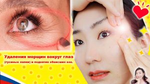 Удаления морщин вокруг глаз (гусиные лапки) и поднятия обвисших век. Imi's Bigan Yoga