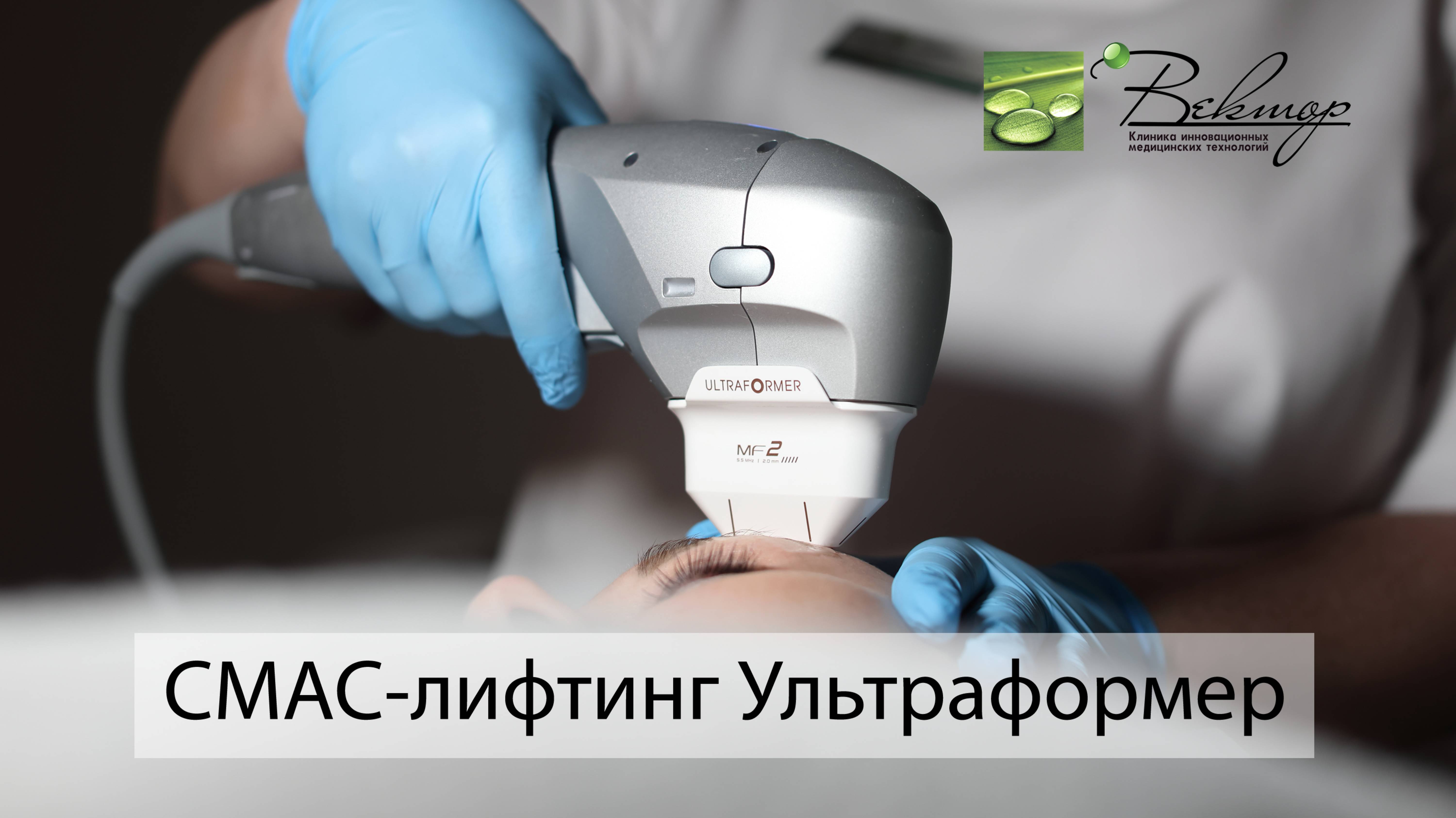 Ультразвуковой СМАС-лифтинг Ультраформер смотреть онлайн