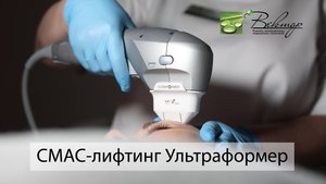 Ультразвуковой СМАС-лифтинг Ультраформер
