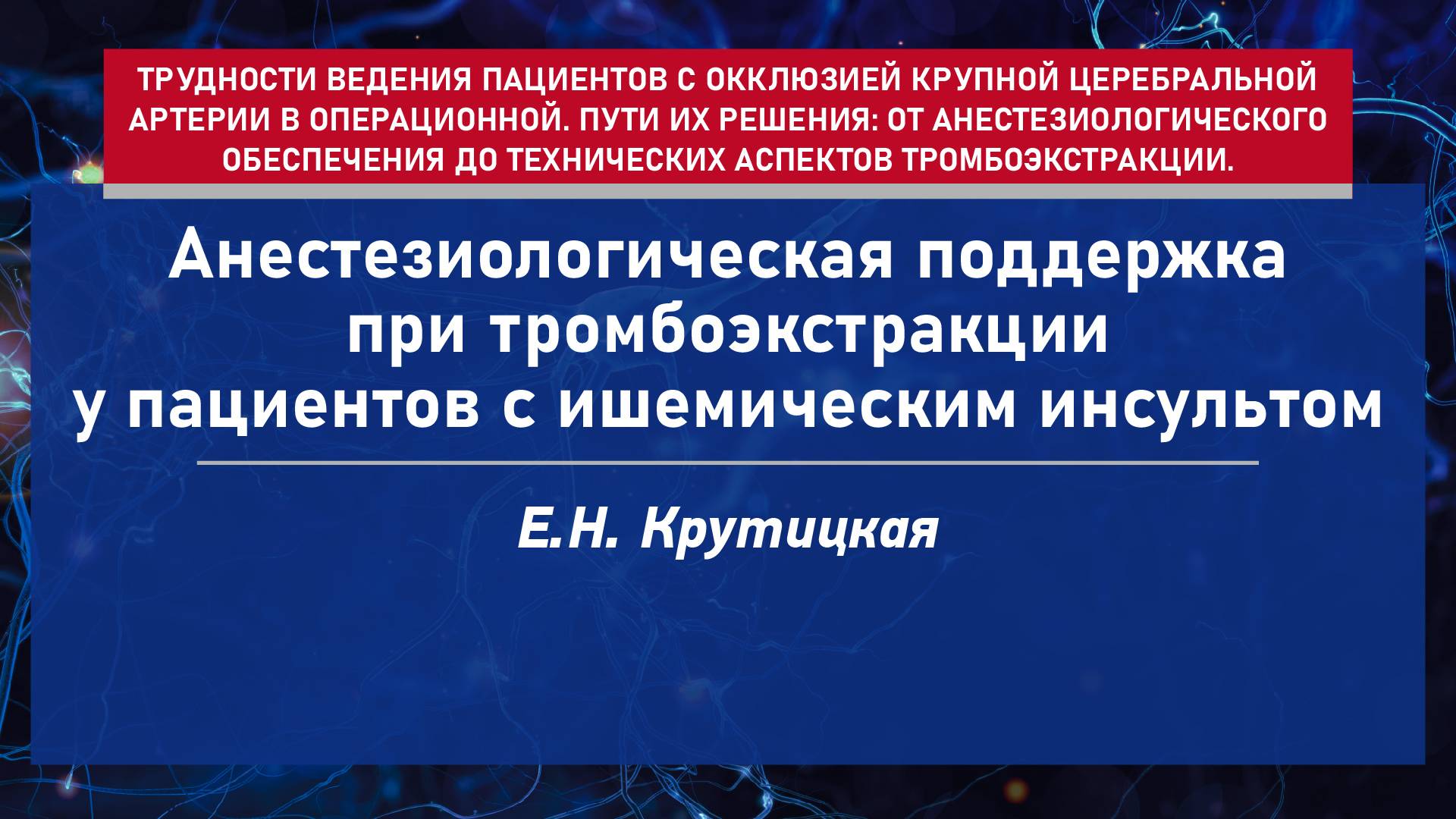 Анестезиологическая поддержка при тромбоэкстракции у пациентов с ишемическим инсультом