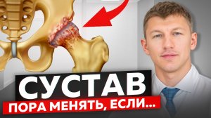 3 симптома, что пора на операцию по замене сустава / Проверь себя, пока еще не поздно!