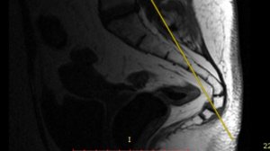 Мобильность крестца, дыхание и как можно восстановить его положение
