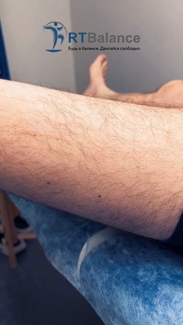 Большая подвижность суставов - гипермобильность