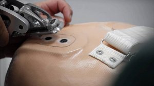 Изготовление протеза: процесс