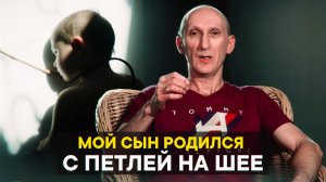 Мой сын родился с петлей на шее