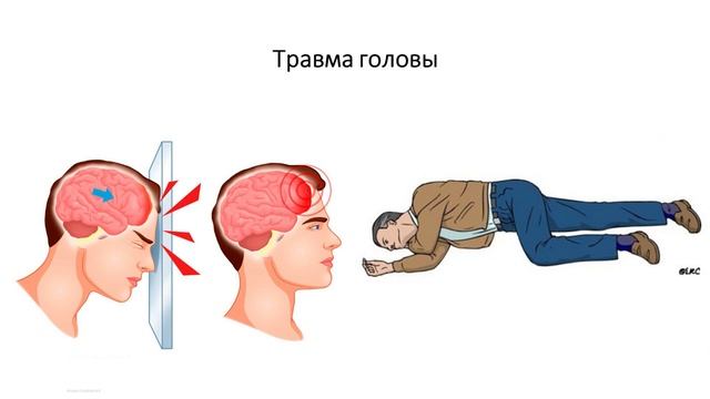 ПП-2
