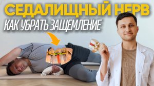 Как облегчить боль от седалищного нерва? Лечебные позы для снятия защемления