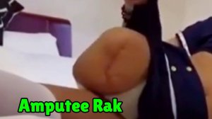 Amputee Rak
