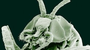 ОНХОЦЕРКОЗ Onchocerca volvulus МЕДИЦИНСКАЯ ПАРАЗИТОЛОГИЯ - Морфология Симптомы Диагностика Цикл