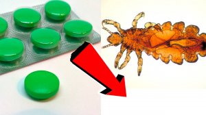 Как избавиться от вшей и гнид За 3 Секунды!.!!!.!