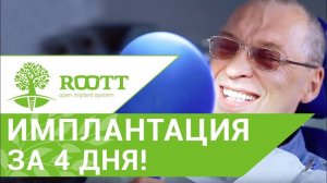 Имплантация зубов нижняя челюсть. Отзыв об имплантации зубов на нижней челюсти. ROOTT.
