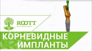 Зубные импланты виды. О некоторых видах зубных имплантов ROOTT.