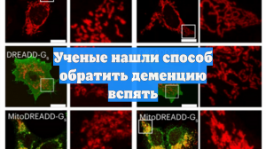 Ученые нашли способ обратить деменцию вспять