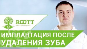 Установка импланта после удаления зуба. В чем преимущество установки импланта после удаления зуба