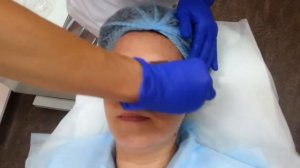 Феруловый пилинг для лица...