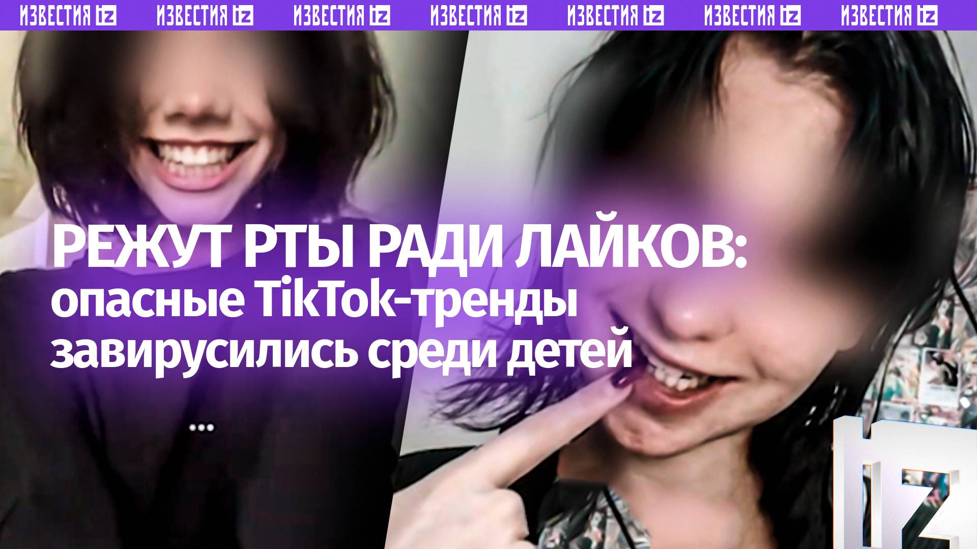 Рот Джокера в моде у поколения альфа: дети режут рты ради лайков