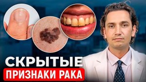 Скрытые признаки РАКА! НЕ ИГНОРИРУЙ ЭТИ СИГНАЛЫ!