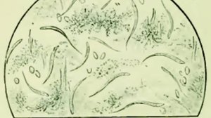 Угрица Кишечная Strongyloides stercoralis Морфология Размеры Жизненный Цикл Диагностика Профилактика