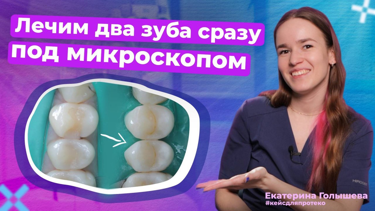 Как лечат кариес под микроскопом?