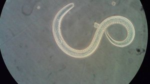 Анкилостомидозы_ Анкилостомоз (Ancylostoma duodenale) и Некатороз (Necator americanus)