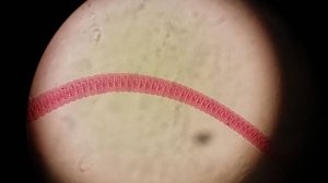 Гименолепидоз - Карликовый Цепень_ Строение Морфология Жизненный Цикл Диагностика Профилактика