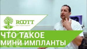 Мини импланты Установка съемного протеза на мини импланты в ROOTT