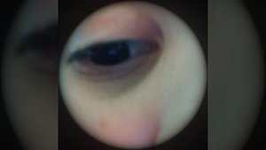 сумасшедший