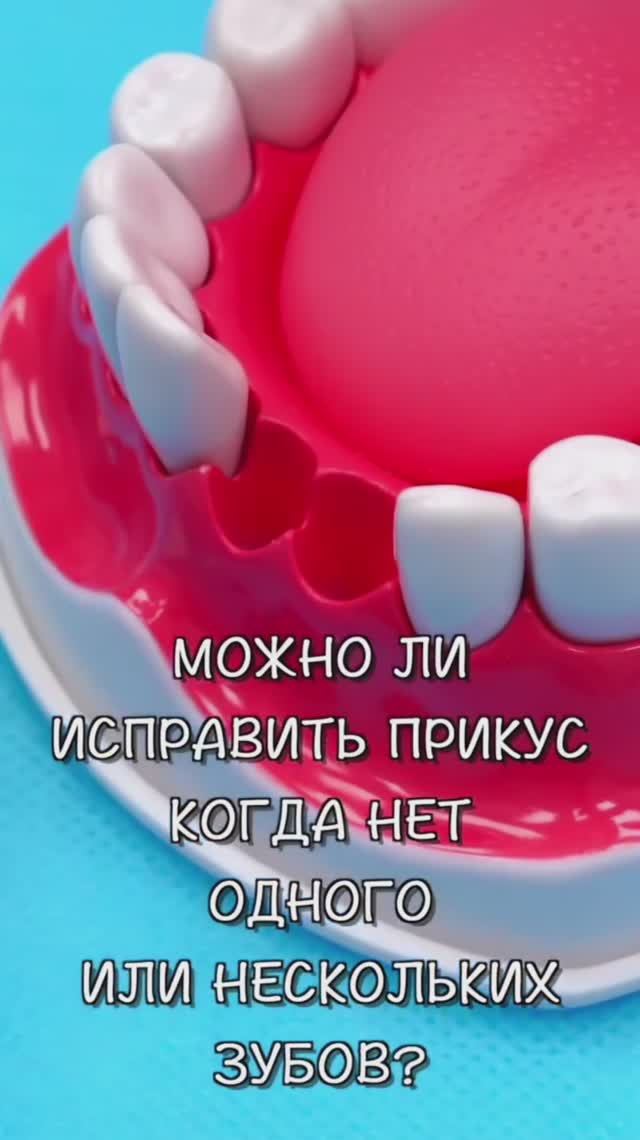 Исправление прикуса если удалены зубы  ZemsClinic.ru